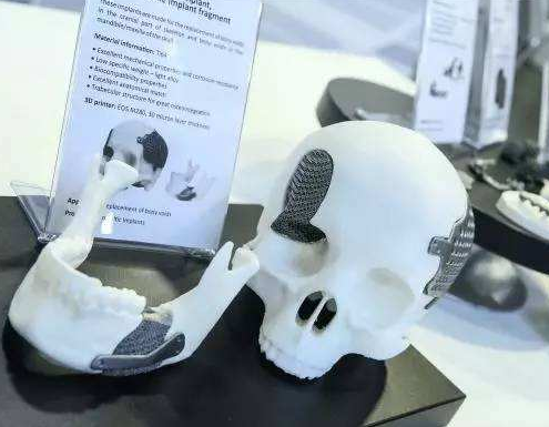 3D打印在医疗行业中的应用介绍